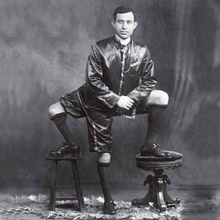 Frank Lentini, homem de três pernas