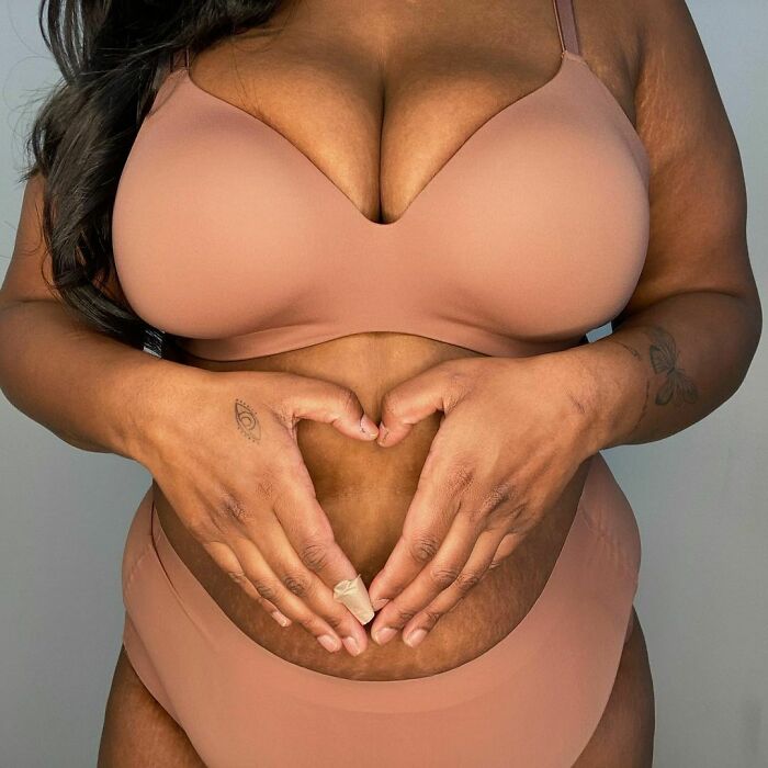 20 mulheres postam fotos não editadas para "normalizar corpos normais"