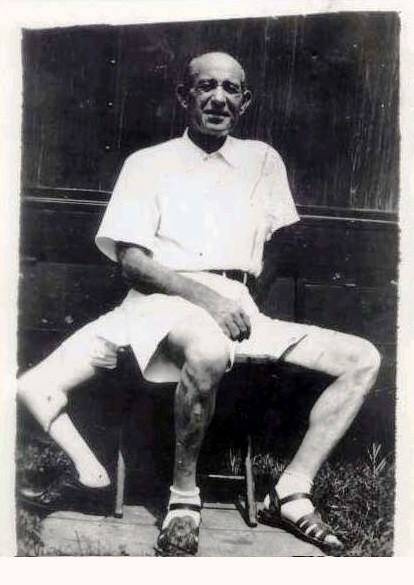 Frank Lentini, homem de três pernas