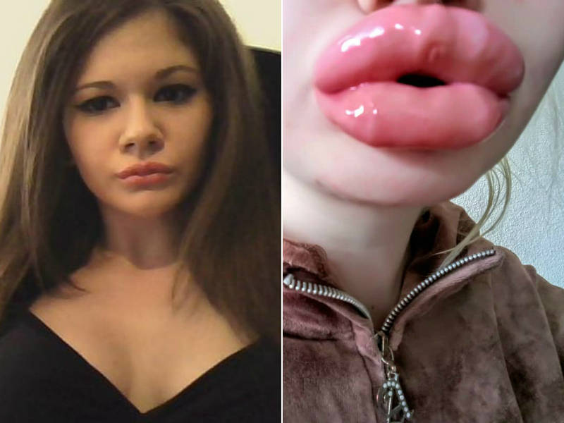 Conheça Andrea Ivanova, a mulher búlgara com os 'maiores lábios do mundo'
