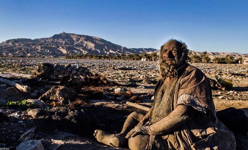 O homem mais sujo do mundo: iraniano não toma há 67 anos